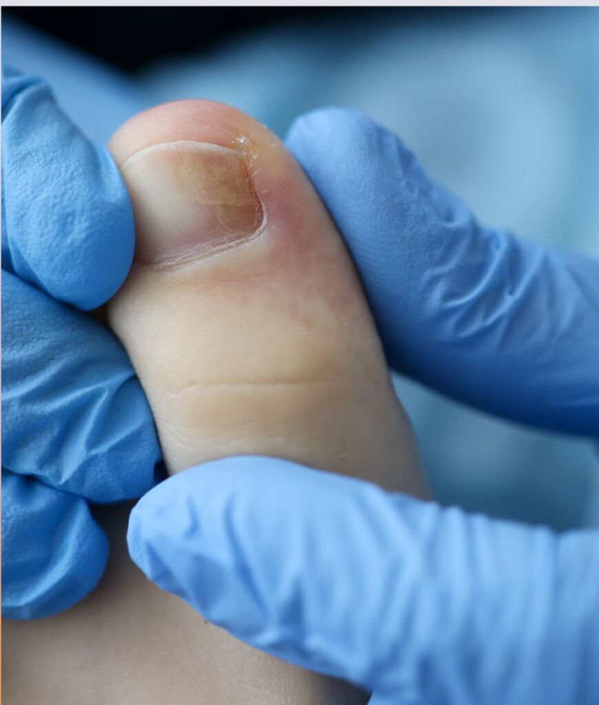 Hair and Nail Care in Bangladesh